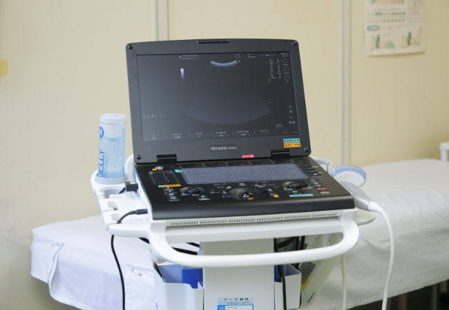 超音波診断装置